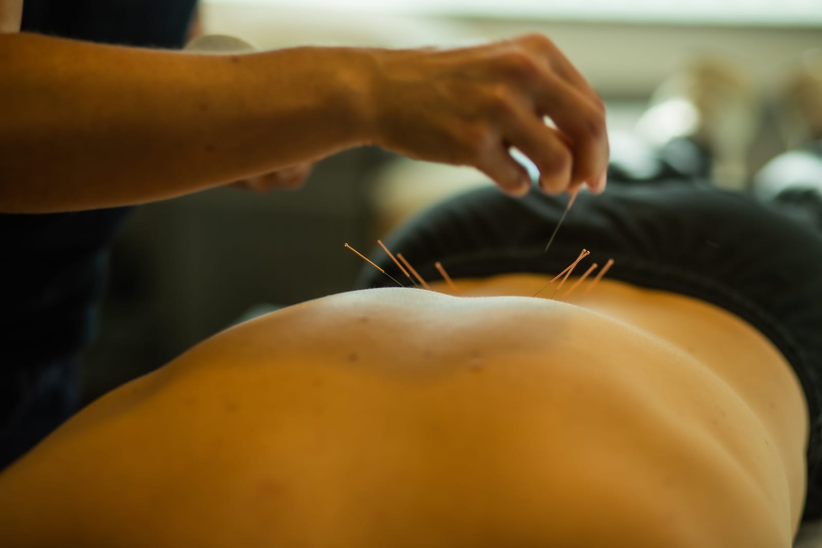 Nålebehandling av korsryggen hos Klinikk Libra